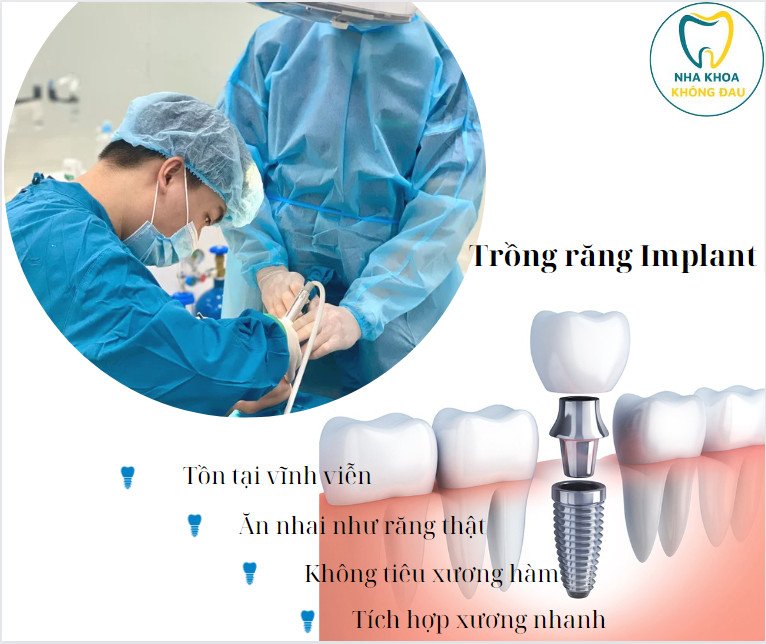 Trồng răng Implant làm 1 lần dùng trọn đời